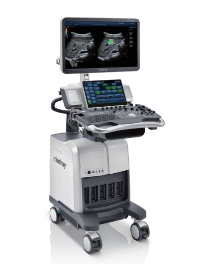 Mindray DC-80 X-Insight Main View